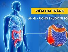 Viêm Đại Tràng Uống Gì